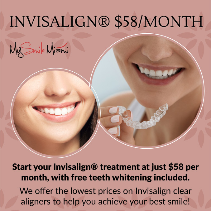 special offer invisalign and teeth whitening at just $58 per month