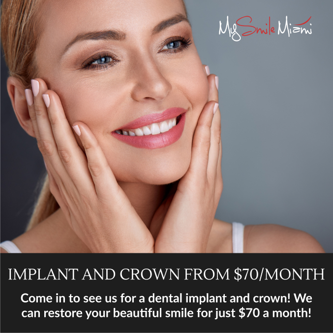 special offer implant and crown from $70 per month